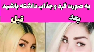 با قرص چاقی صورت یه صورت گرد و جذاب داشته باشید!