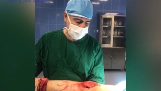کلیپی از عمل جراحی زانو در داخل اتاق عمل
