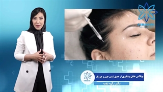 بوتاکس، معجزه ای برای پیشگیری از عمیق شدن چین و چروک ها