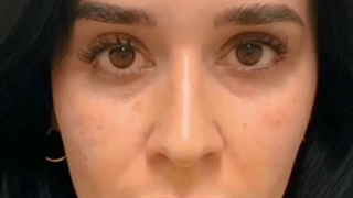 فیلم درمان سریع سیاهی دور چشم