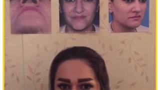 رضایت از عمل بینی