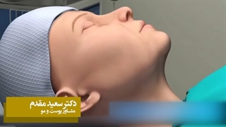 فیلم واقعی لیفت صورت
