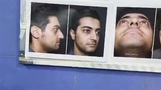 جراحی بینی مردانه