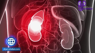 مراقبت های افراد تک کلیه ای