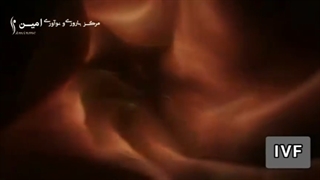 انیمیشن IVF