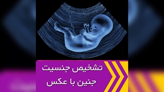 آیا تشخیص جنسیت جنین با عکس امکان پذیر است؟