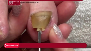 آموزش پدیکورو مانیکور -پدیکور پاهای آسیب دیده