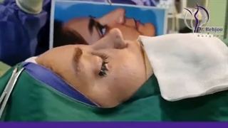 فیلم واقعی جراحی بینی خواهران دوقلو در اتاق عمل