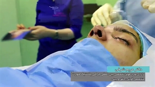 فیلم عمل زیبایی بینی
