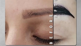 آیا کاشت ابرو انتخابی مناسبی است؟