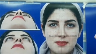 جراحی ترمیمی بینی
