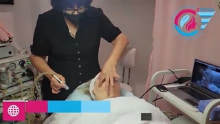 کلاس‌های عملی میکرودرم‌ابریژن