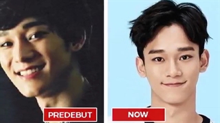 اعضای EXO قبل عمل زیبایی و بعد از عمل