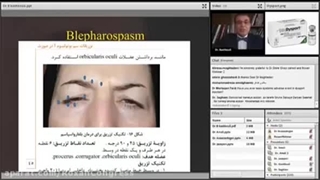 صحبت های دکتر کشکولی درباره تزریق بوتاکس دیسپورت پارت 2