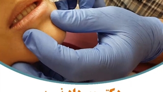 اصلاح فرم لب