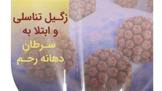 زگیل تناسلی و ابتلا به سرطان دهانه رحم