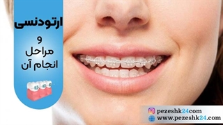 فیلم مراحل ارتودنسی در مشهد