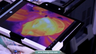 از بین بردن رفع آکنه و جوانسازی پوست Aphrodite