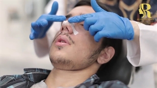 نحوه صحیح چسب زدن به بینی بعد از عمل