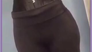 همه چیز درباره لیفتینگ برزیلی فرم دادن به باسن با تزریق ژل و چربی اصلاح فرم صورت
