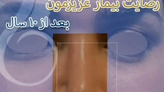 جراحی زیبایی بینی