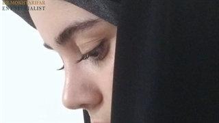 سه ماه پس از جراحی بینی نتیجه رو ببین!