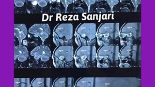 جراحی تومور