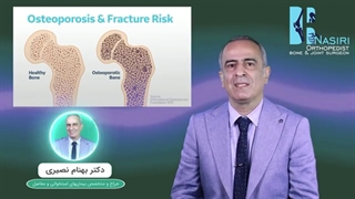 روش های تشخیص پوکی استخوان کدامند؟