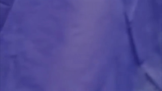 تعویض همزمان دو طرفه مفصل زانو