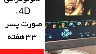 فیلم سونوگرافی 4d