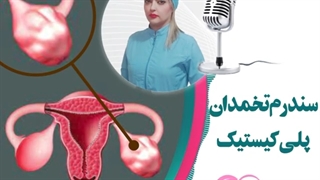 موضوع : درمان سندروم تخمدان پلی کیستیک