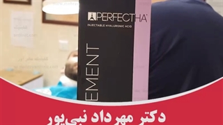رفع گودی زیر چشم