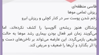 علت و دلایل ریزش ابرو و راه درمان آن