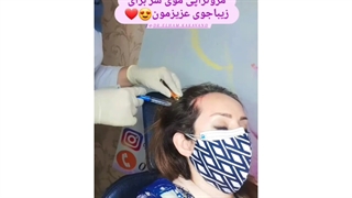 مزوتراپی‌مو