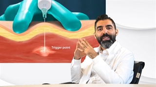 تزریق نقاط تحریک پذیر یا تریگر پوینت