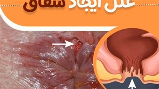 علل ایجاد شقاق