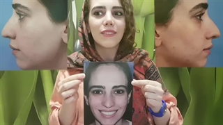 فیلم رضایت از جراحی بینی| دکتر سعید ظفرمند