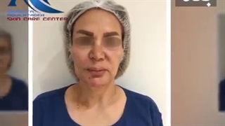 فیلم واقعی از کانتورینگ صورت