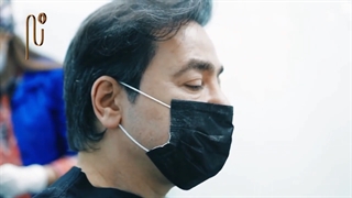 فیلم اتاق عمل کاشت مو دکتر نیلفروش زاده