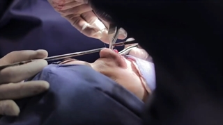 فیلم واقعی و بدون سانسور جراحی زیبایی بینی