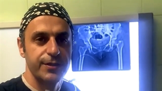 درمان شکستگی گردن ران و ساق پای بیمار در یک مرحله با جااندازی باز