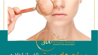 بیماری های پوستی و کرونا!!