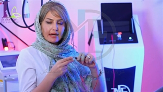 جوانسازی پوست با Endo-RF Subcision