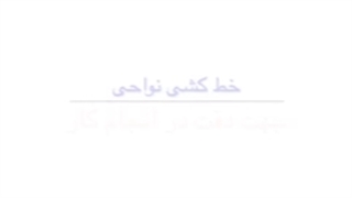لیزر موهای زائد