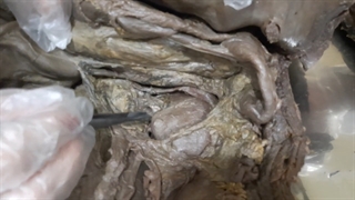 جسد.سیستم ادراری 2. پزشکی