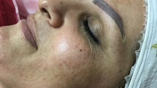 میکرونیدلینگ و کرم پودر دائم # 09120660447