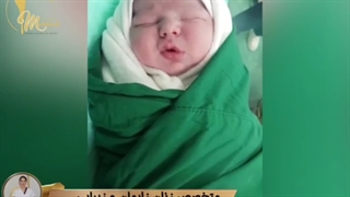 فیلم سزارین دو نوزاد
