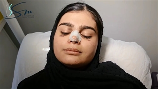 فیلم چسب زدن بینی بعد از عمل