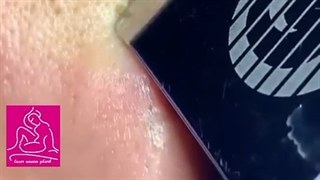 پاکسازی پوست