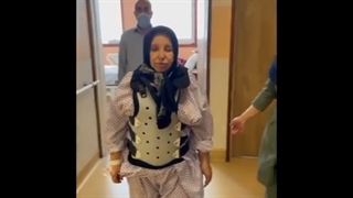 خانم 63 ساله با تنگی بسیار شدید کمری و اسکولیوزیس